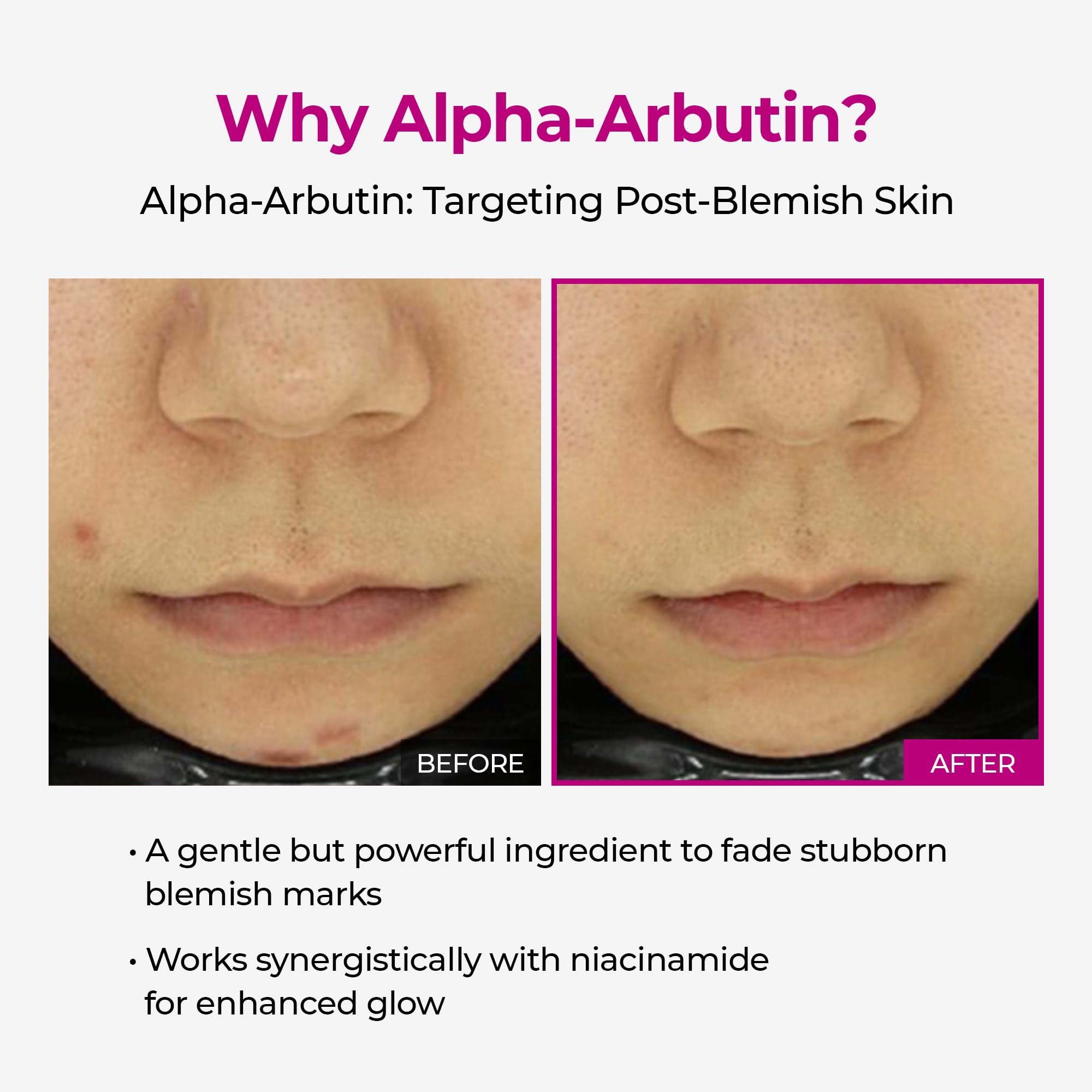 Dr.Melaxin label close-up highlighting alpha-arbutin and niacinamide benefits