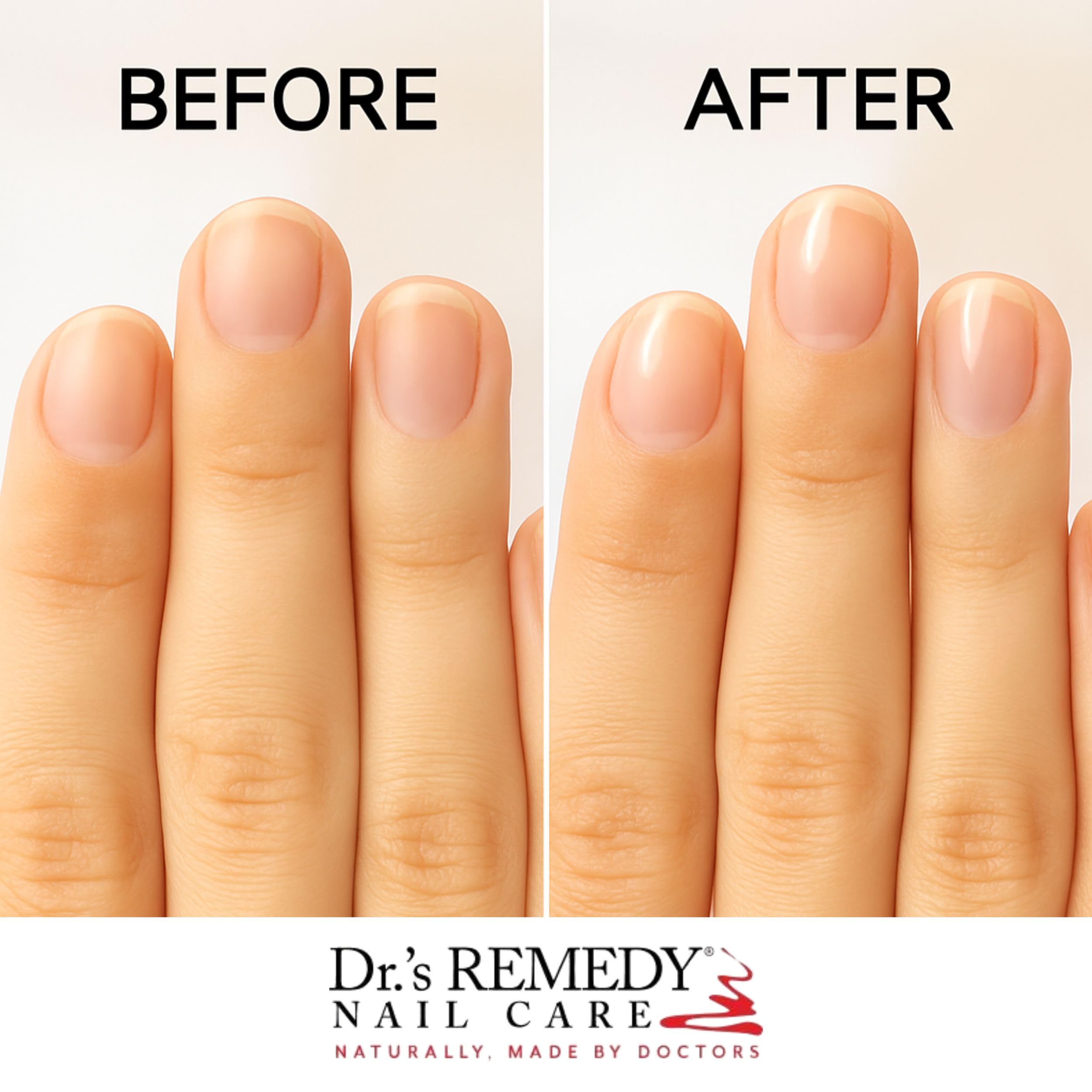 Dr.'s Remedy TOTAL clear polish texture closeup demonstrating glossy quick-dry finish