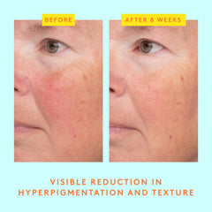Drunk Elephant serum application on hand, illustrates smooth, fast absorption