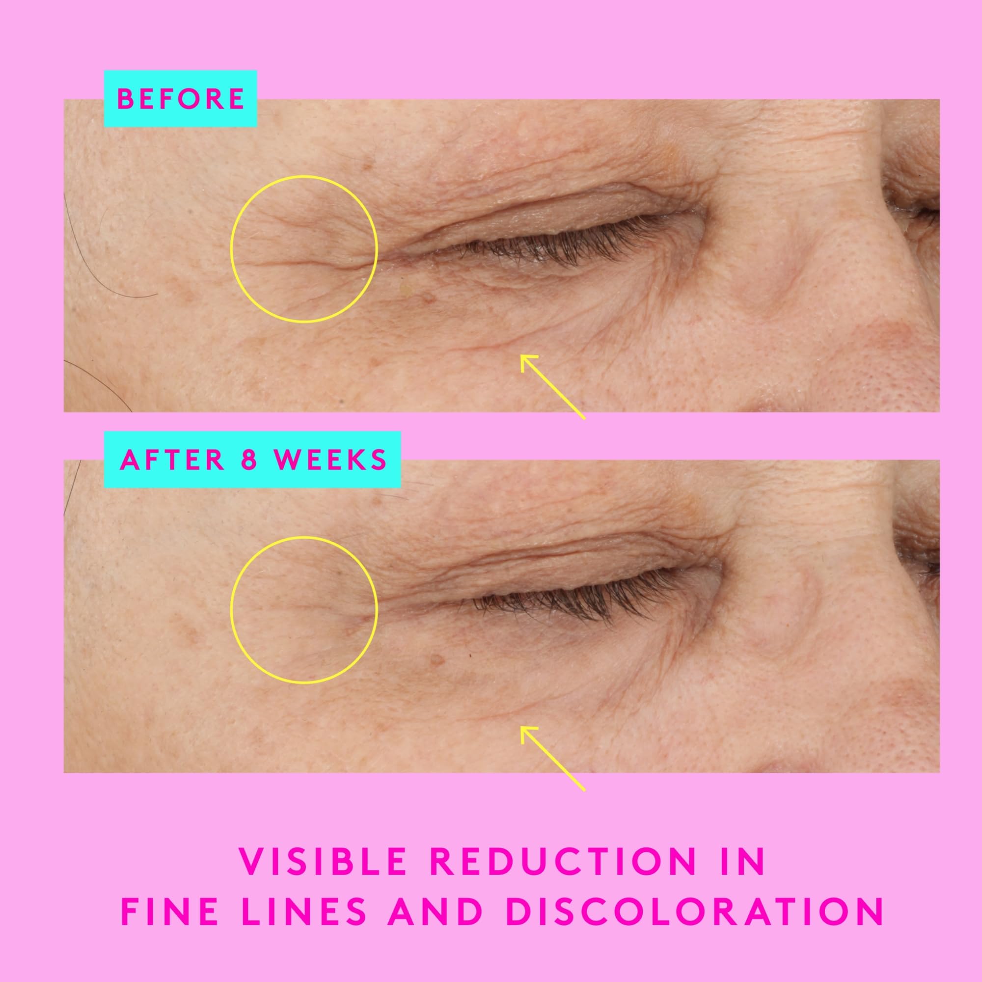 Drunk Elephant applying serum under eye showing reduced puffiness potential