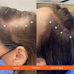 ds labs Spectral Men’s serum nozzle close-up for precise scalp delivery benefit