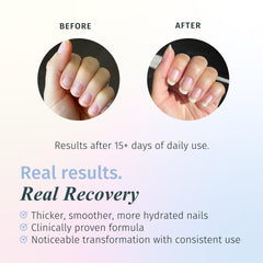 duri Rejuvacote 1 brush and cap detail for precise application and control