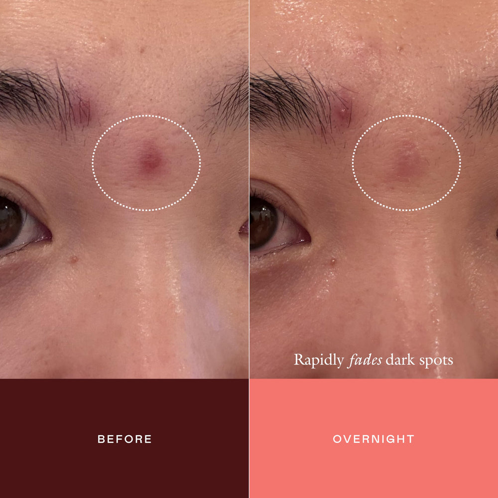 EADEM applying concentrate to cheek spot illustrating targeted coverage benefit