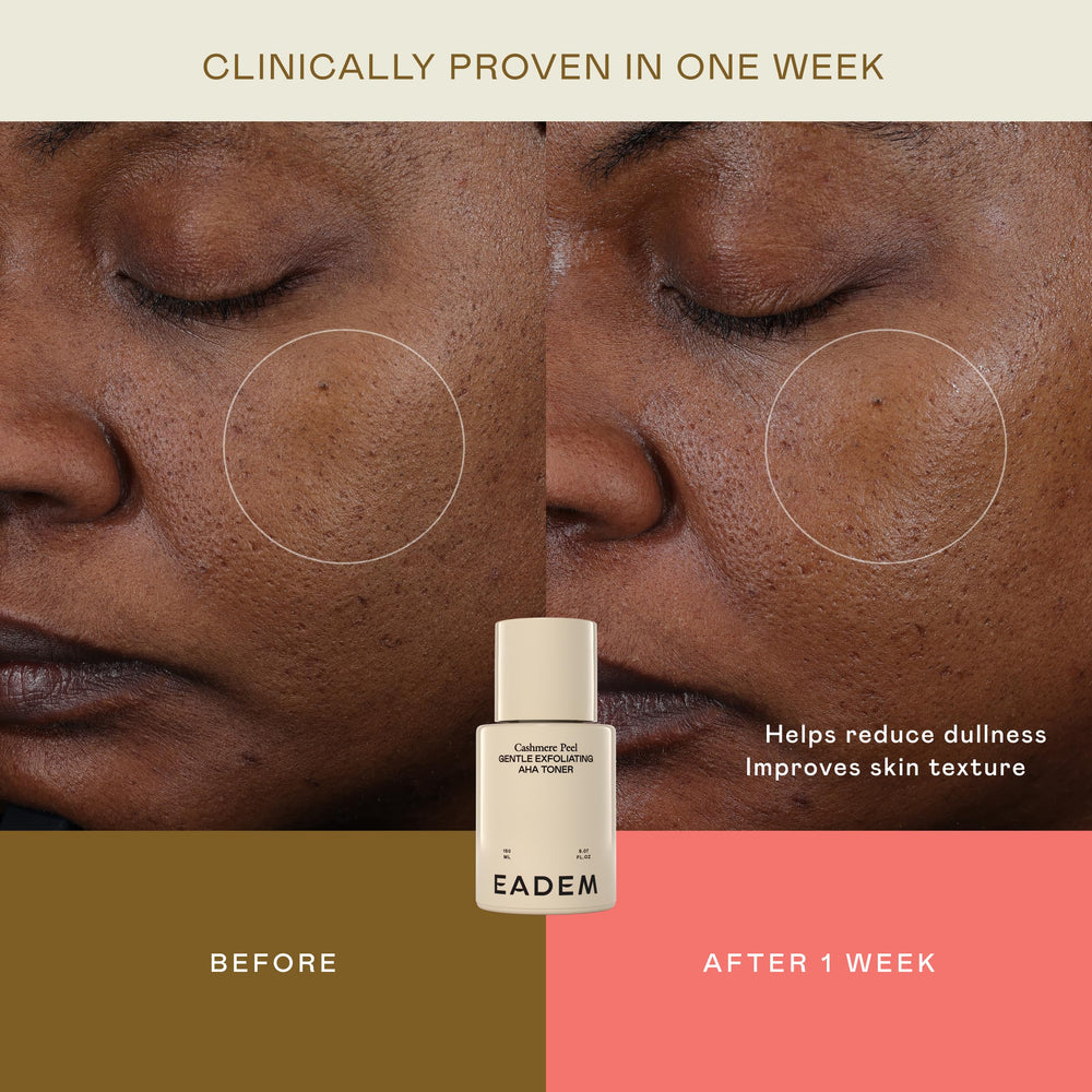 EADEM label detail listing AHA PHA azelaic blend for refined pores
