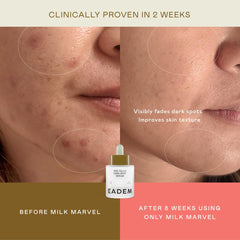 EADEM ingredients display of vitamin C niacinamide and amber algae blend