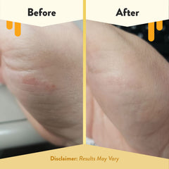 ECZEMA HONEY pad in hand for scale and easy portability benefit