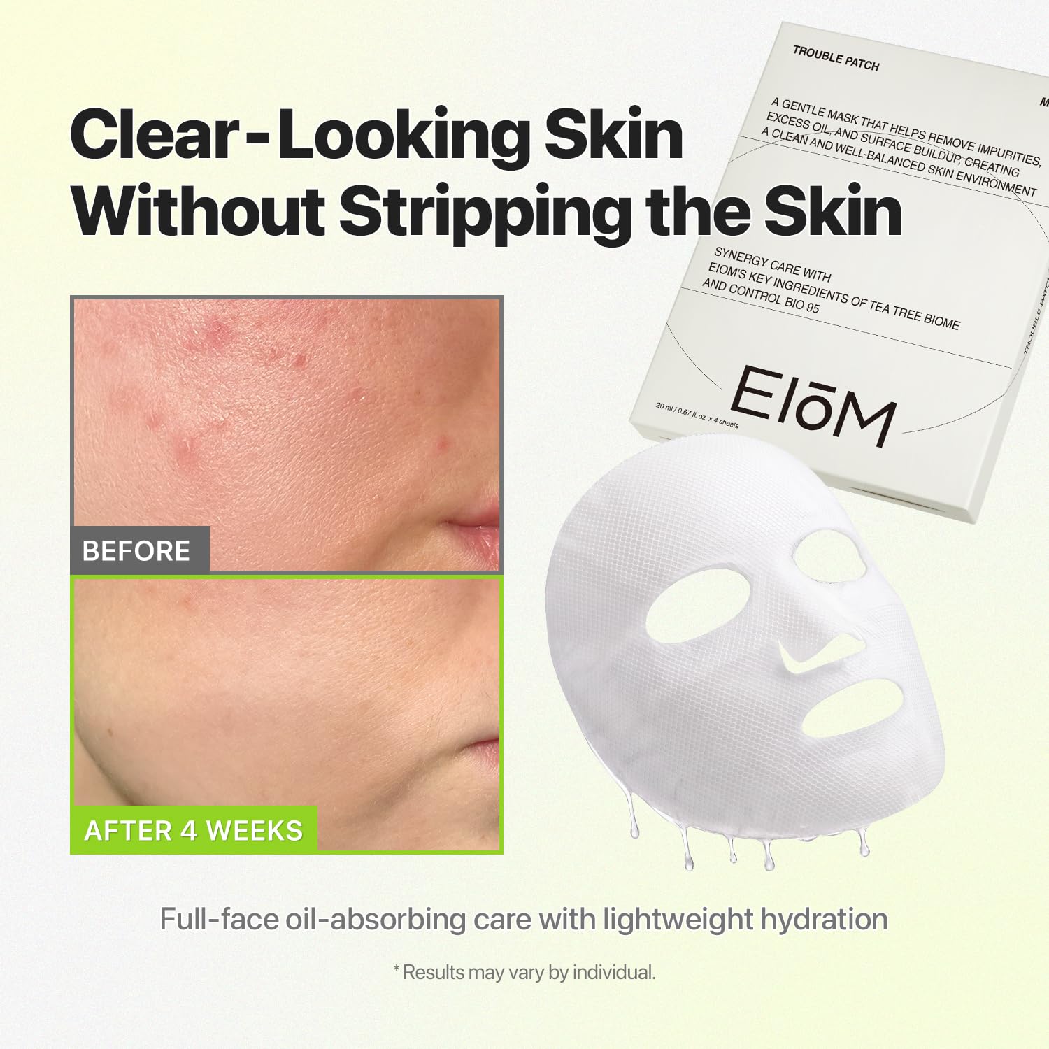 EIOM mask applied on model demonstrating full-face coverage and calming effect