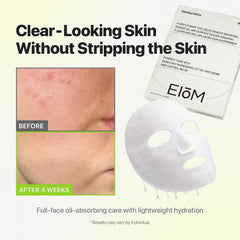 EIOM mask applied on model demonstrating full-face coverage and calming effect