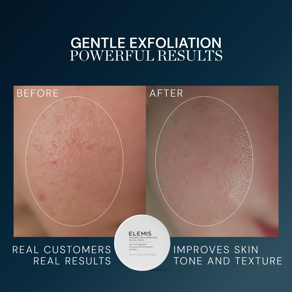 ELEMIS pad solution soaked detail highlighting exfoliating actives and comfort
