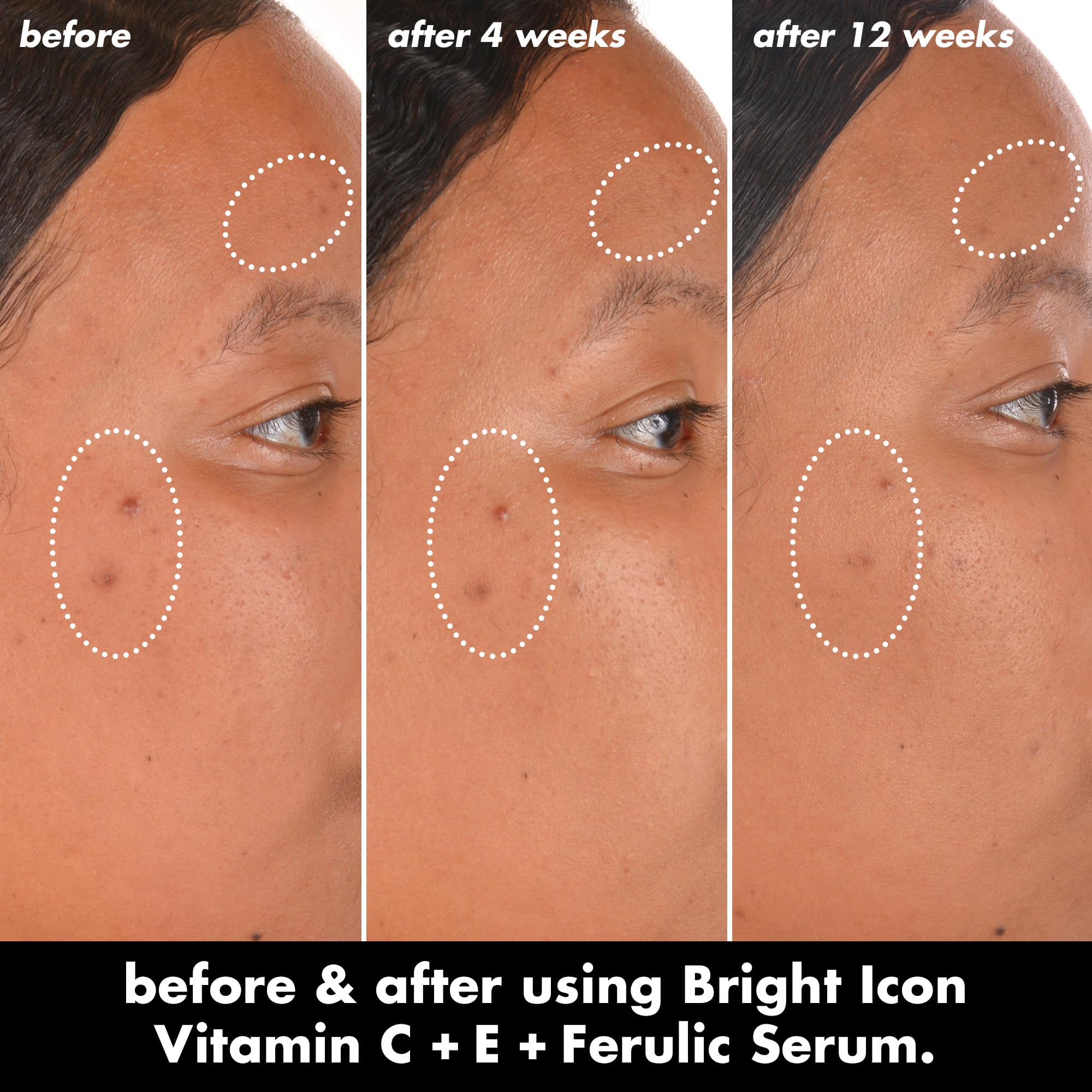 e.l.f. Bright Icon pipette dispensing serum highlighting concentrated formula
