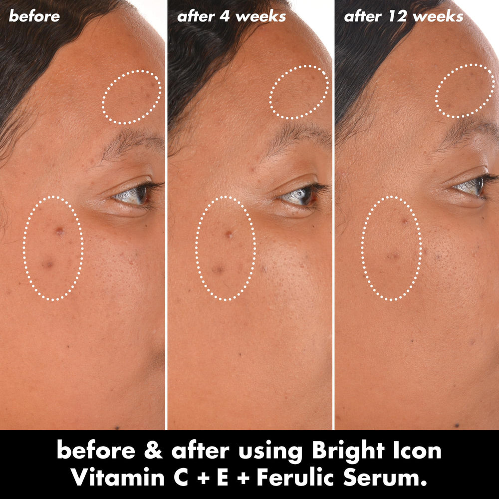 e.l.f. Bright Icon pipette dispensing serum highlighting concentrated formula