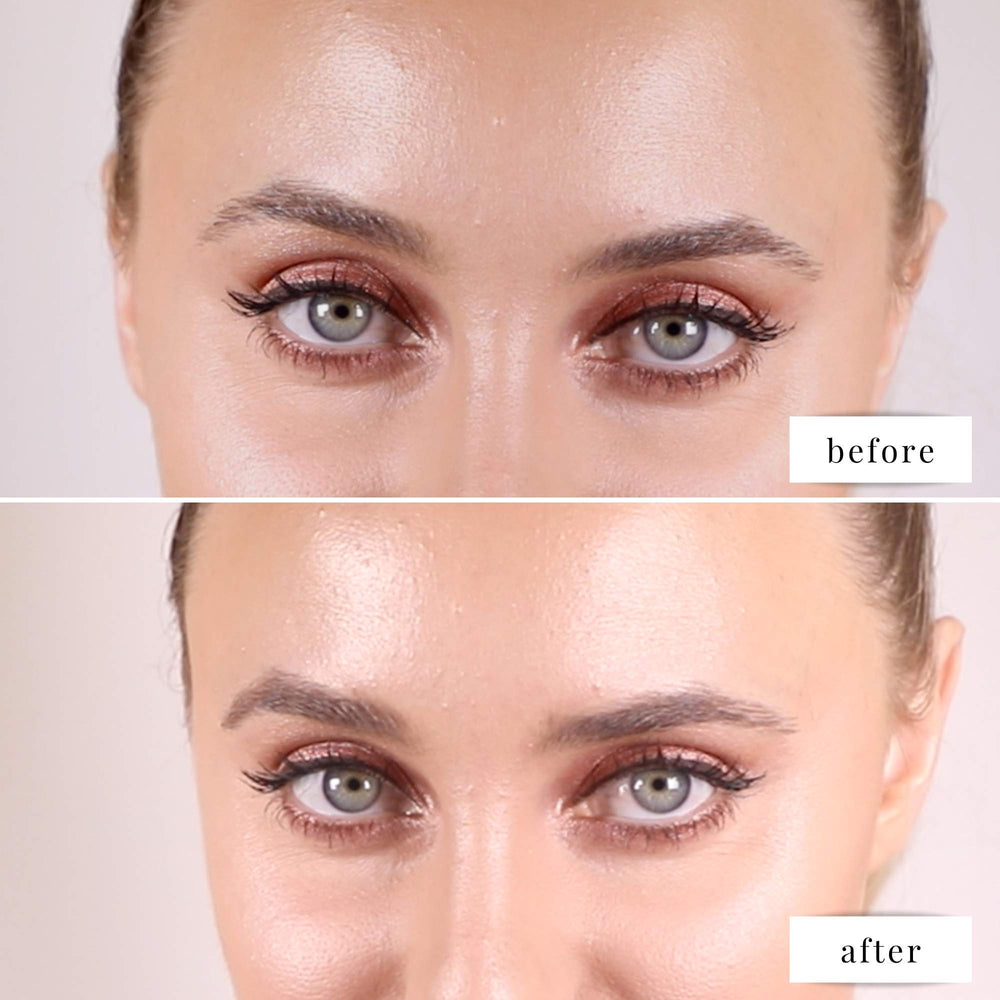 Elizabeth Mott before and after comparison showing visible filling