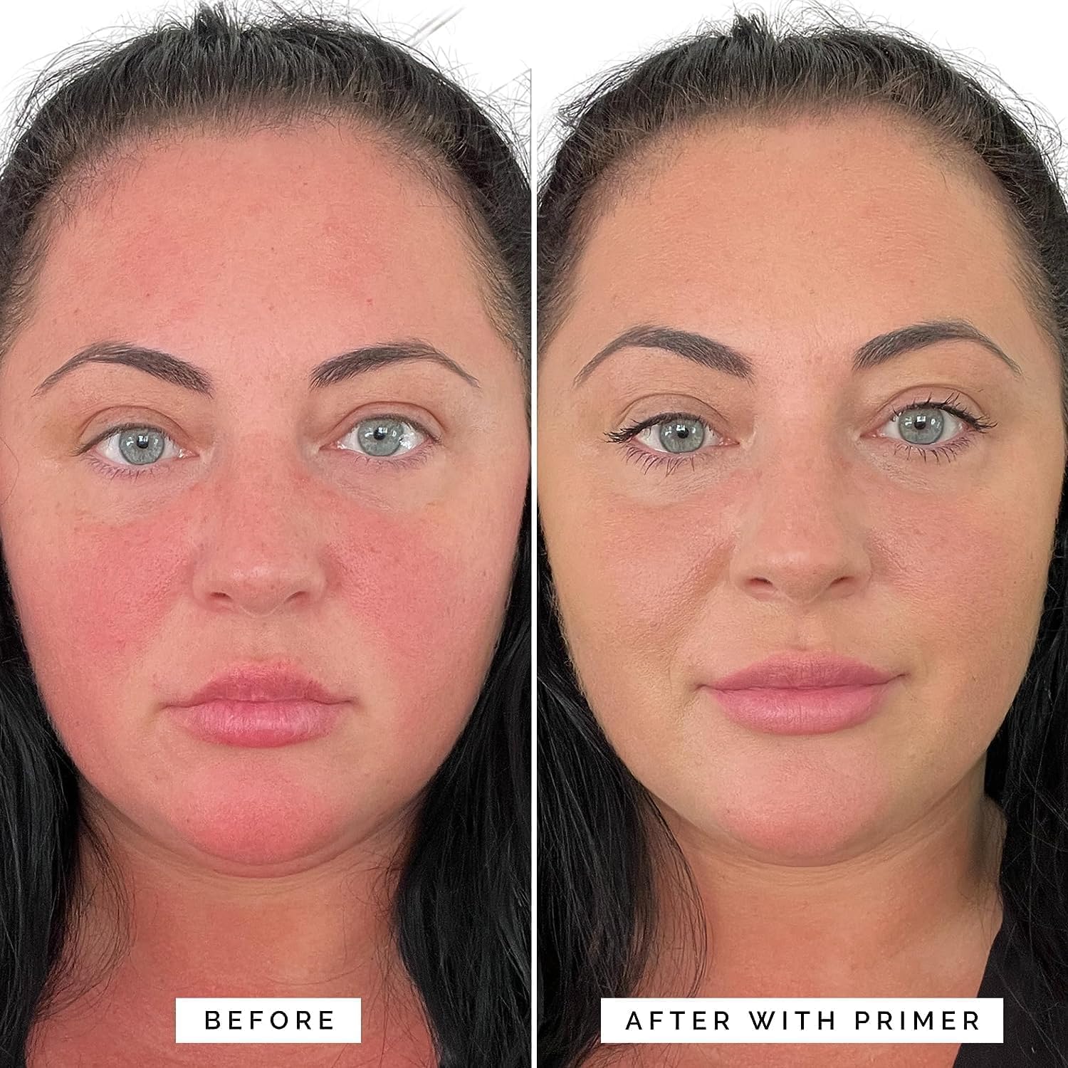 Elizabeth Mott before and after split face illustrating reduced redness and natural finish