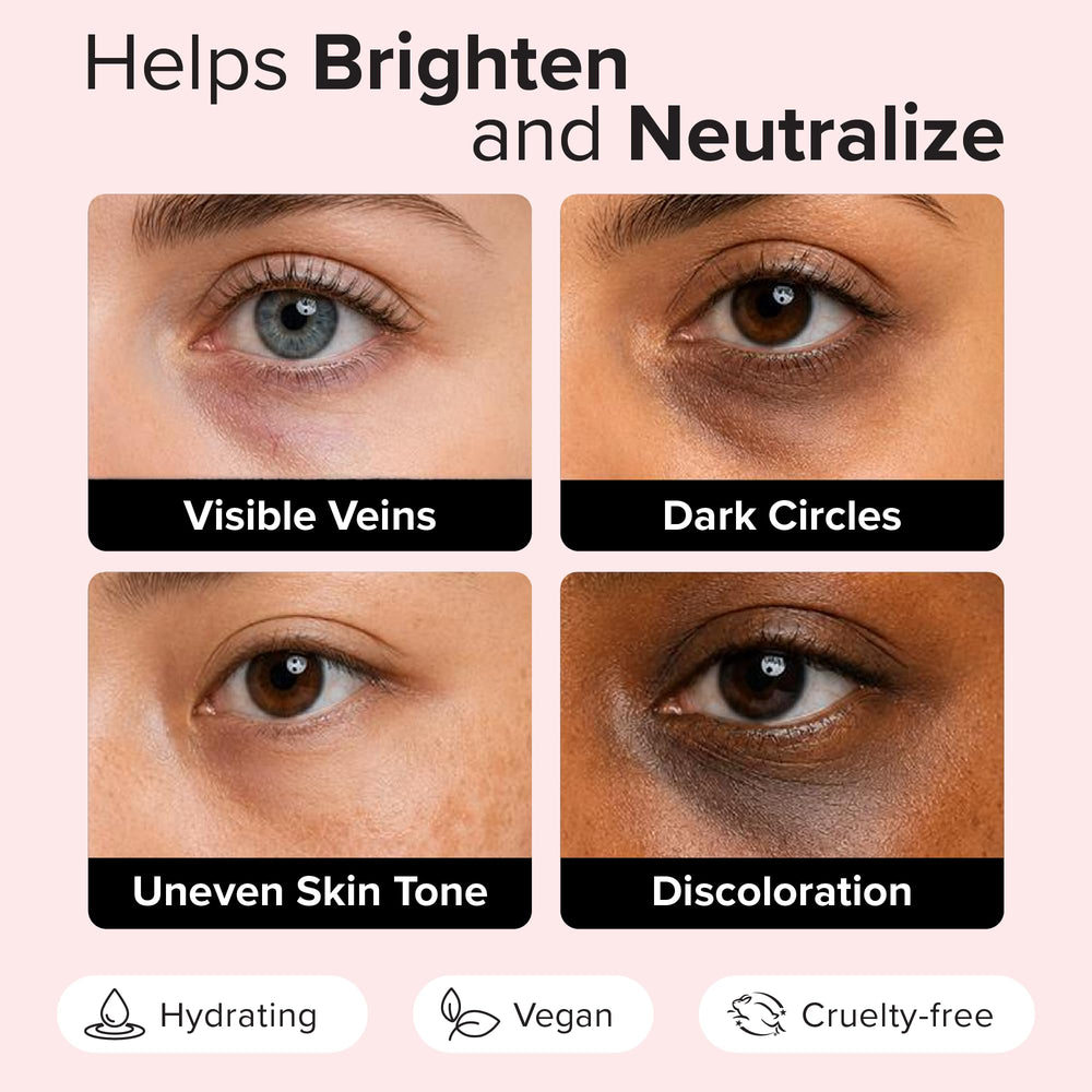 Elizabeth Mott before and after under-eye comparison demonstrating visible brightening