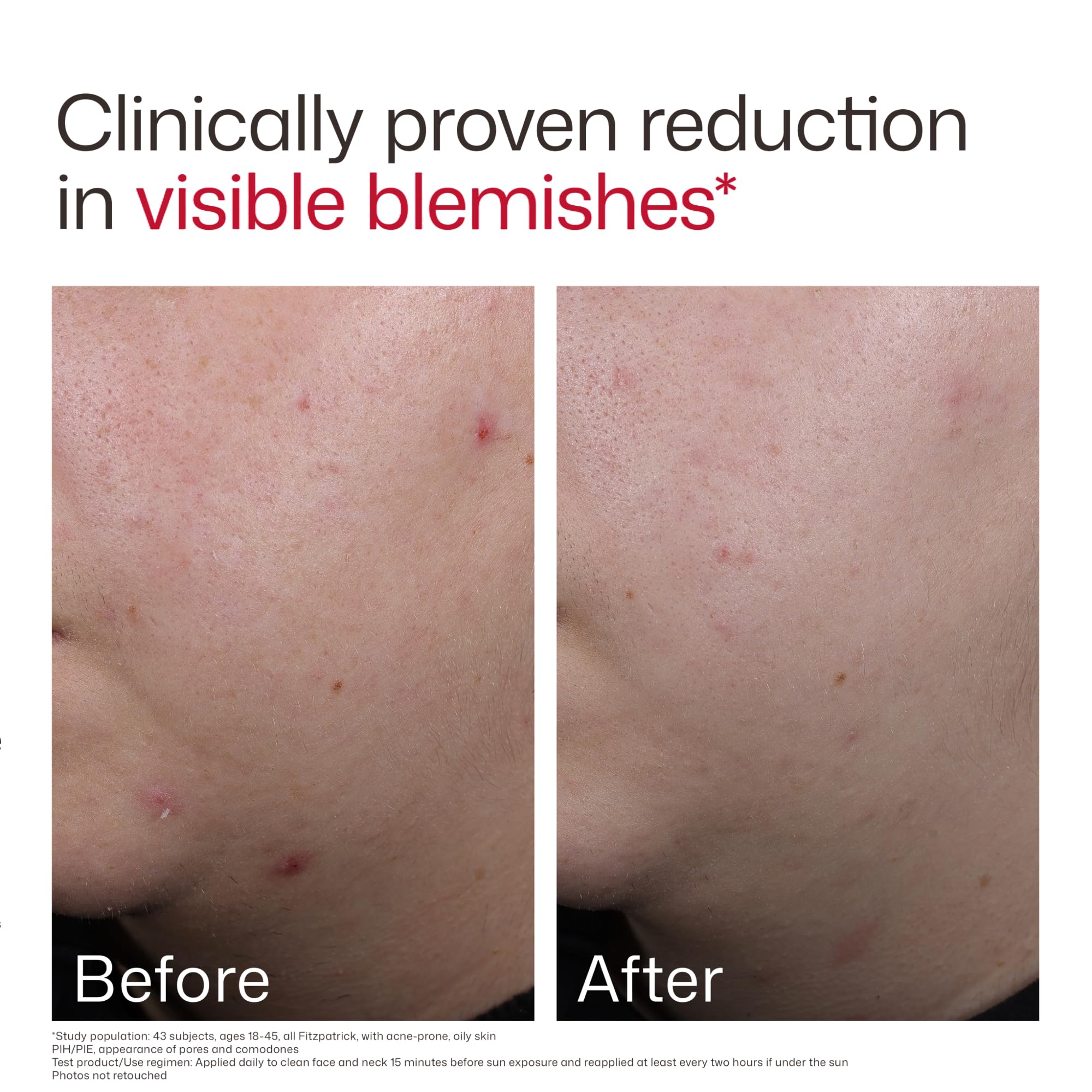 EltaMD applied under makeup on cheek demonstrating compatibility with cosmetics benefit