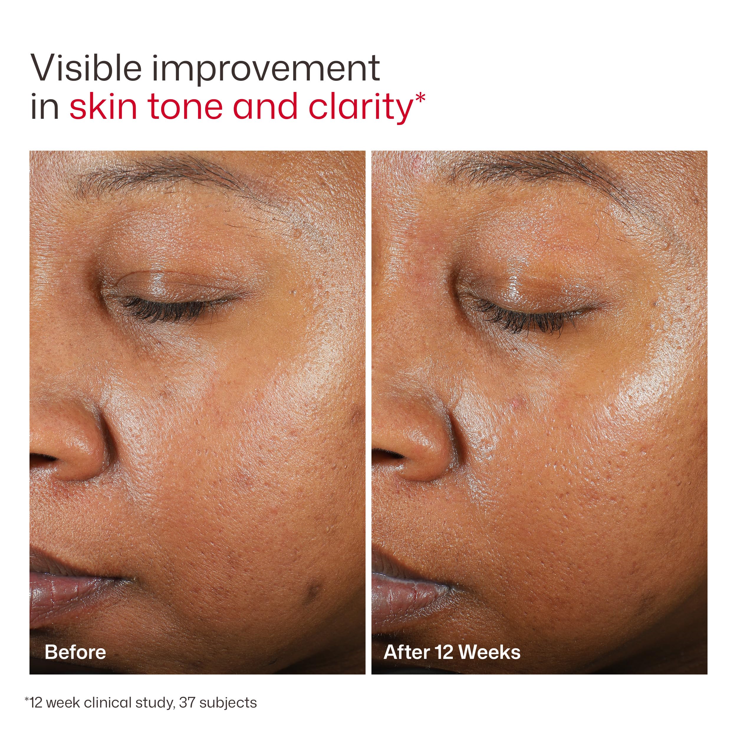 EltaMD UV Clear tinted graphic of zinc oxide illustrating mineral UV protection benefit