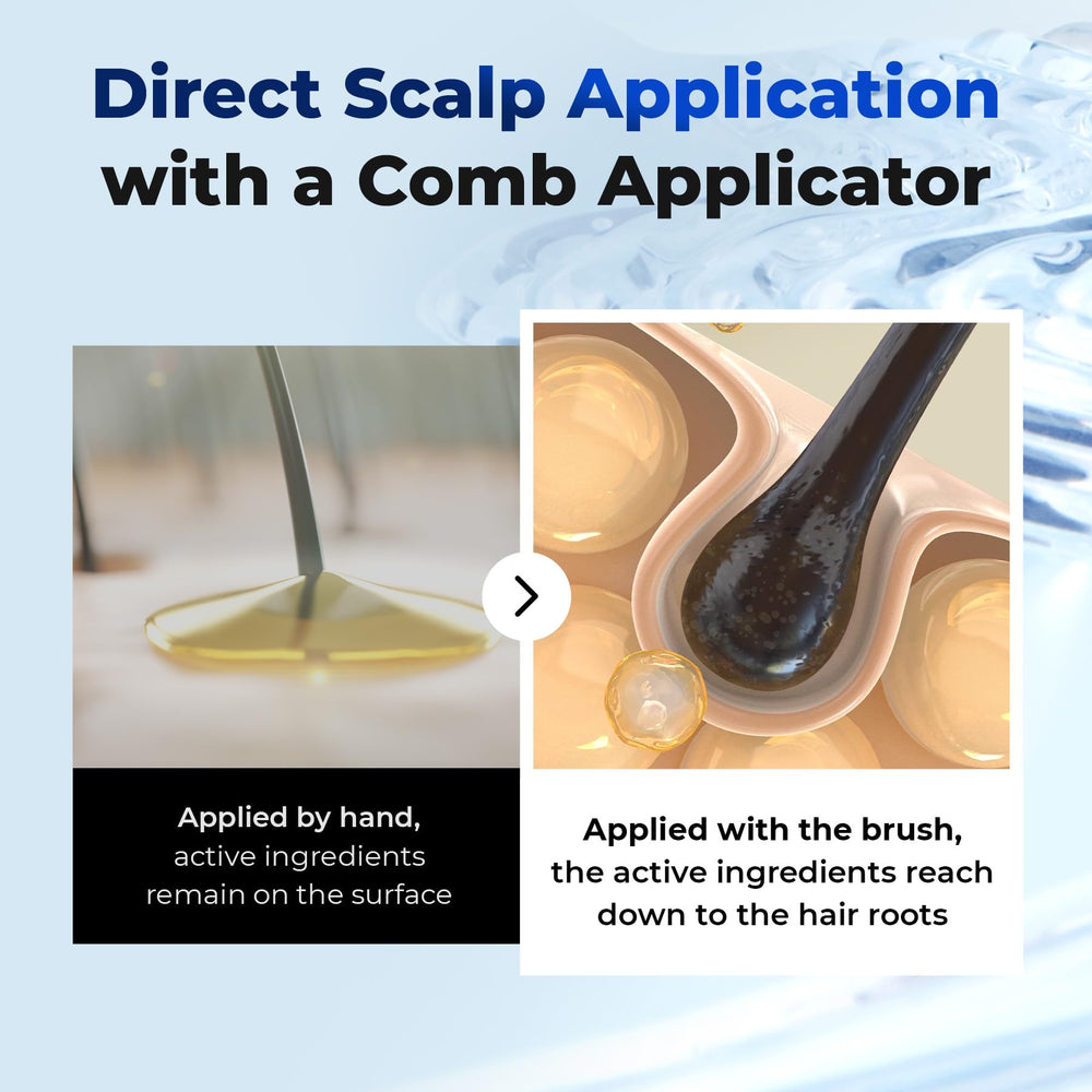 EPAIS being applied to scalp demonstrating mess-free use