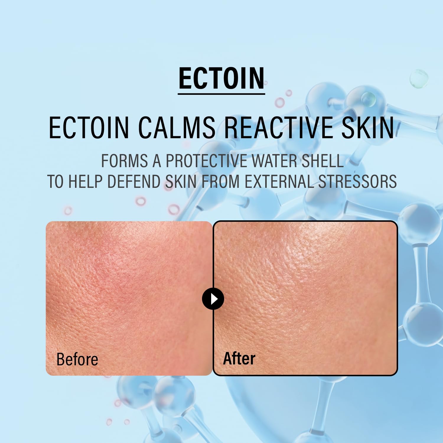 epii ingredient panel close-up showing ectoin squalane niacinamide transparency benefit