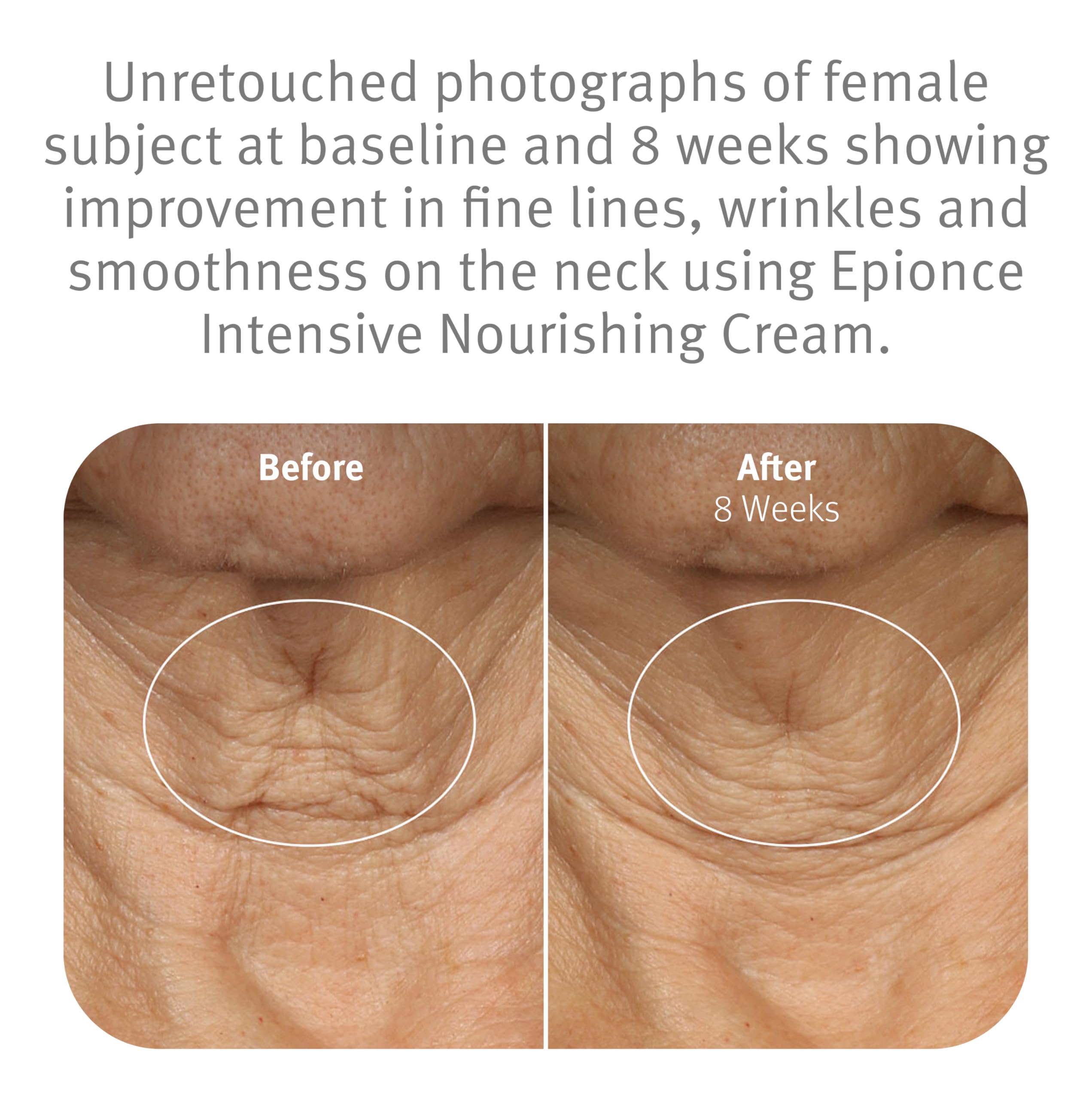 Epionce ingredient display highlighting ceramides to strengthen skin barrier