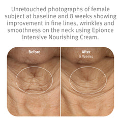 Epionce ingredient display highlighting ceramides to strengthen skin barrier