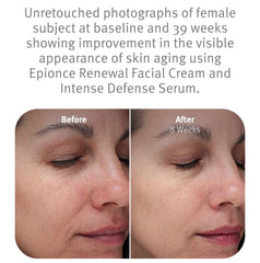 Epionce cream swatched on hand illustrating fast-absorbing hydration benefit