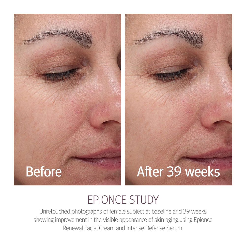 Epionce lifestyle shot of woman applying cream showcasing daily routine and comfort benefit
