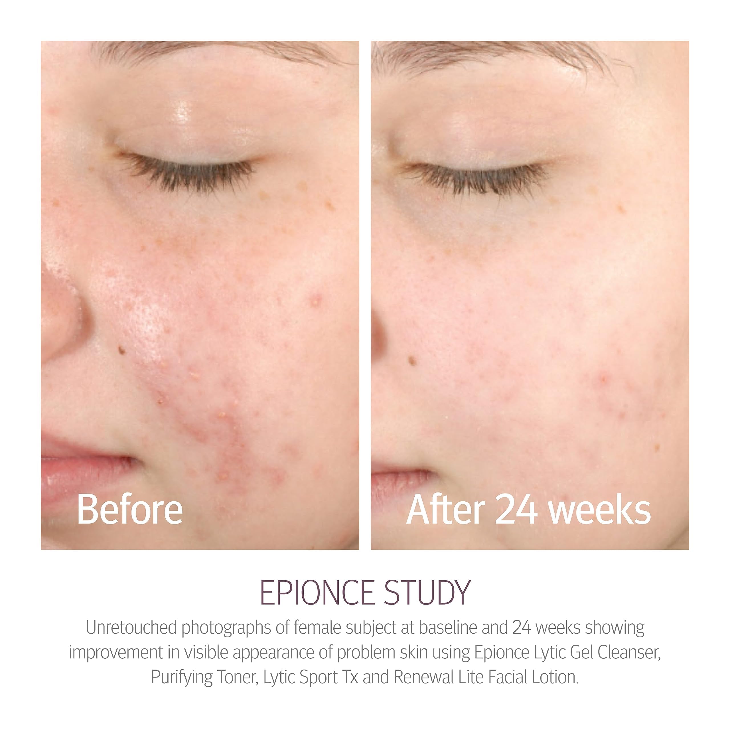 Epionce toner droplet on hand highlighting lightweight texture for quick absorption