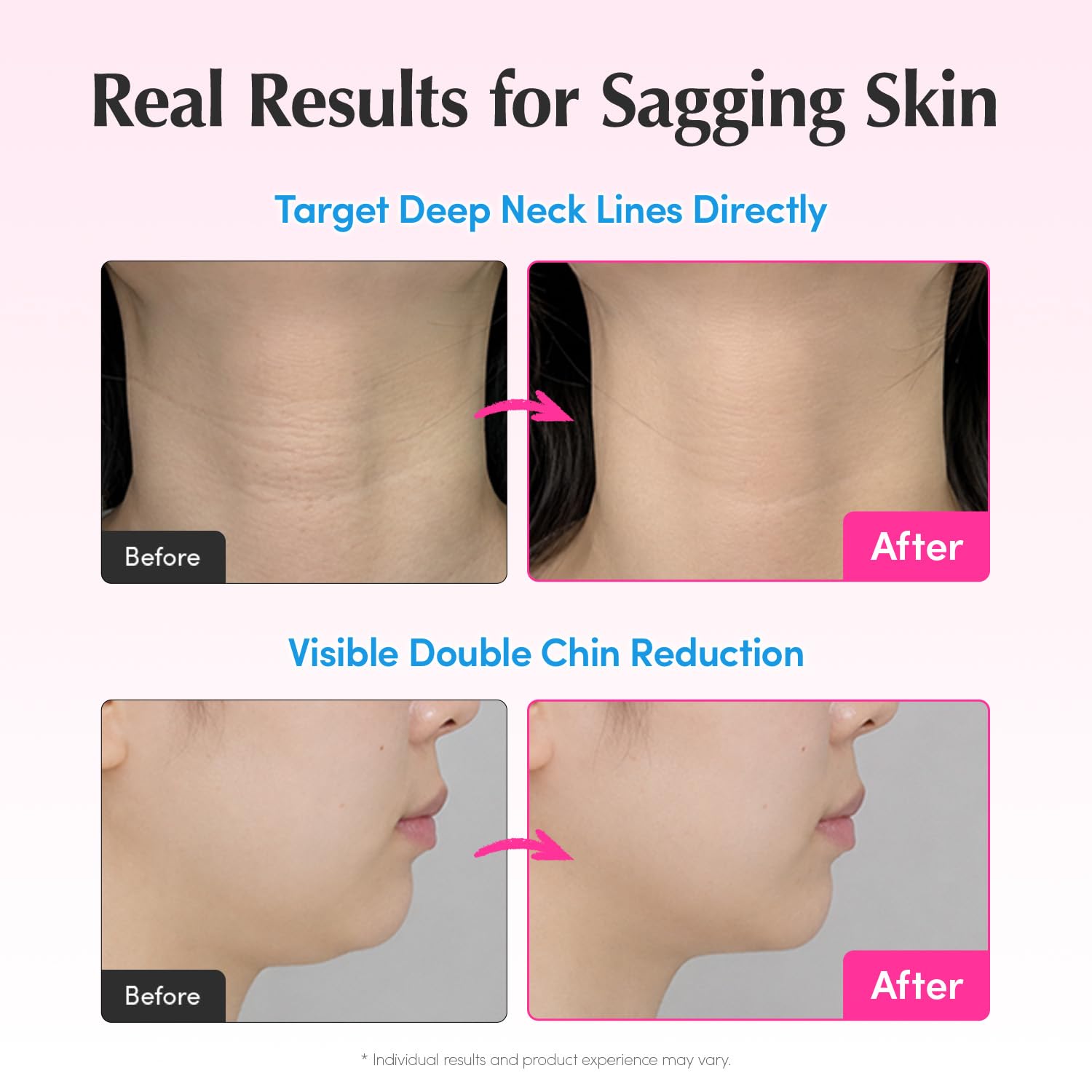 EQQUALBERRY neck and décolleté use in lifestyle setting demonstrating smoothing effect