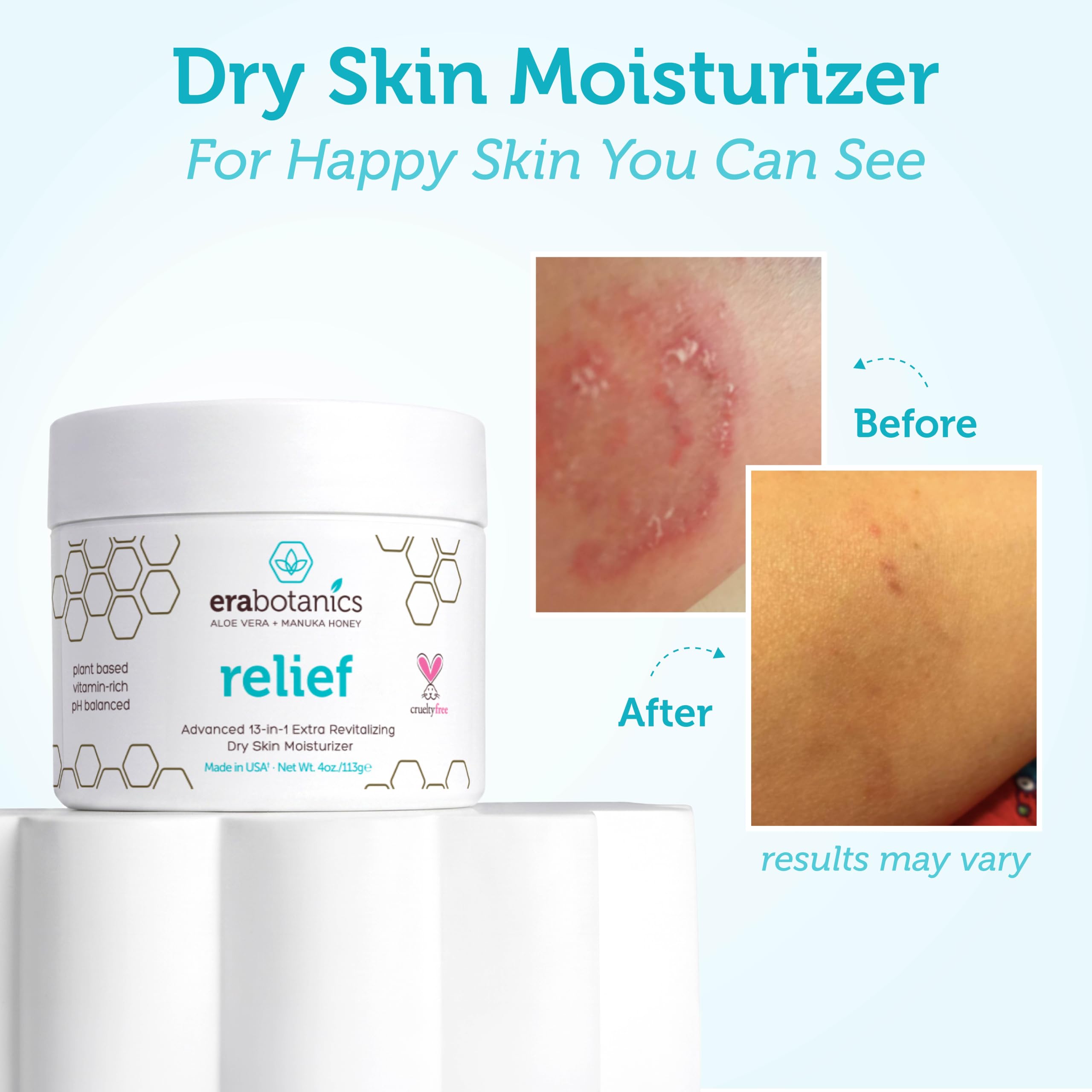 Applying Era Organics to knee and elbow to demonstrate rough patch relief