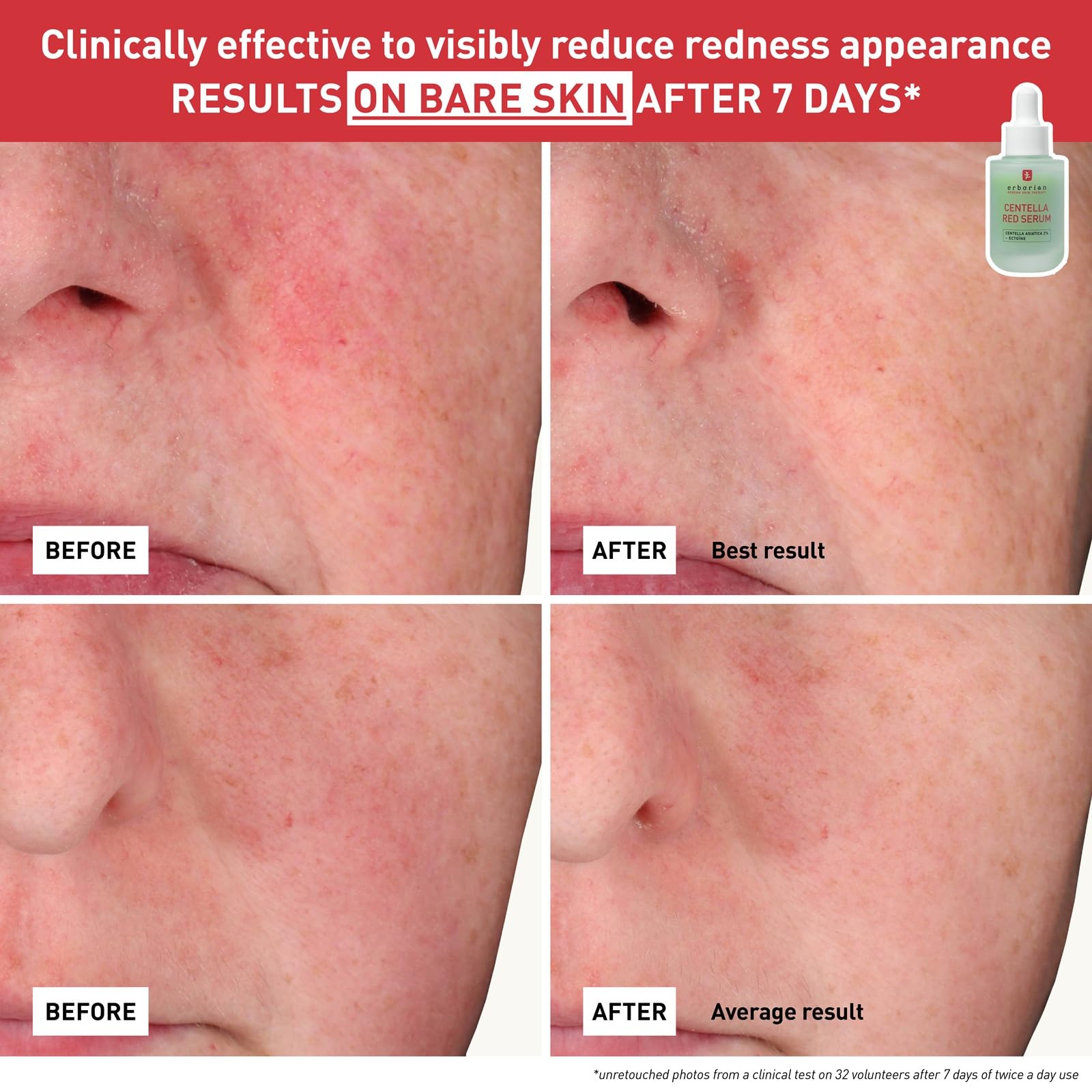 Erborian Centella Red Serum on bathroom shelf in a clean routine setting promoting gentle care