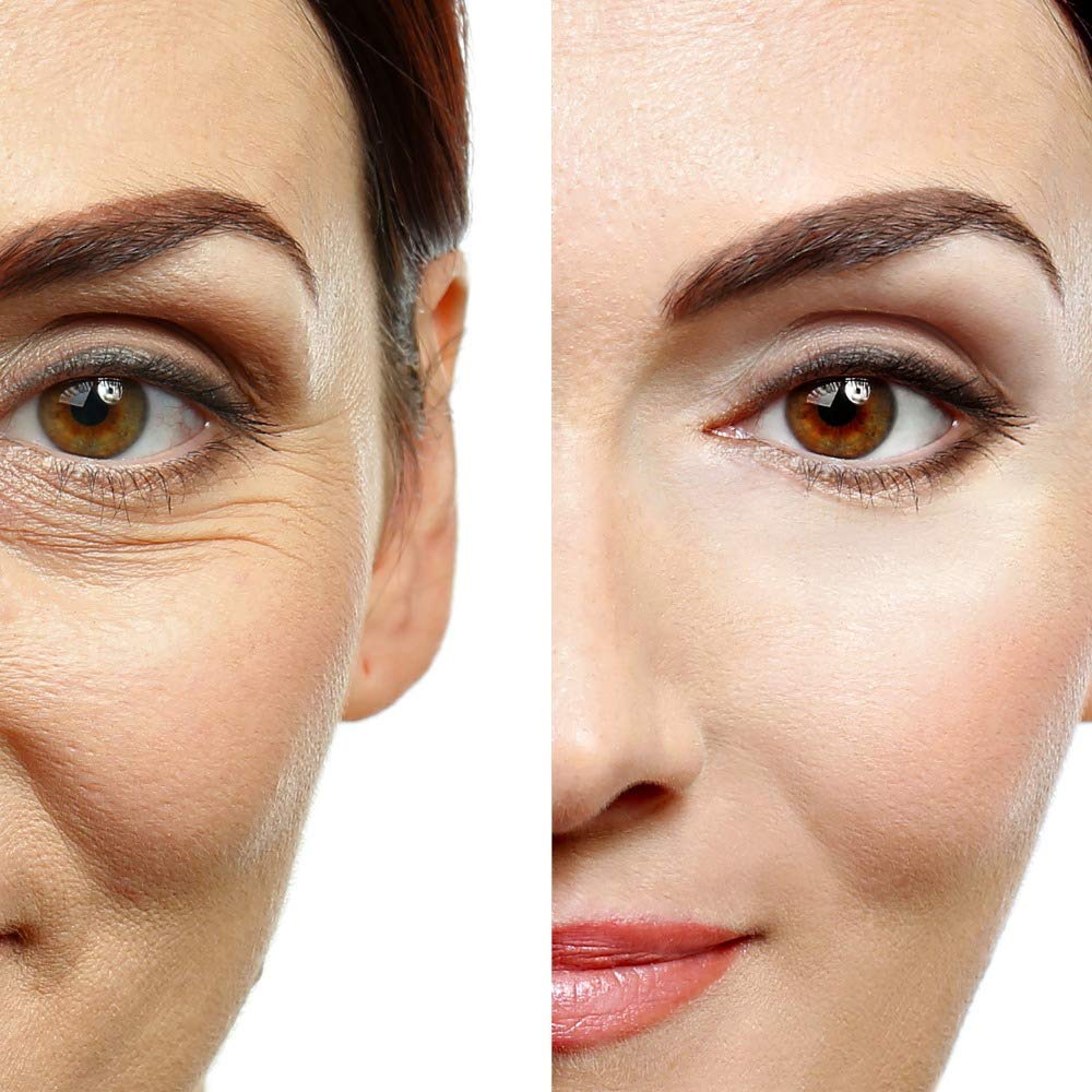 Essence Of Arcadia hyaluronic gloss close-up showing hydrating finish