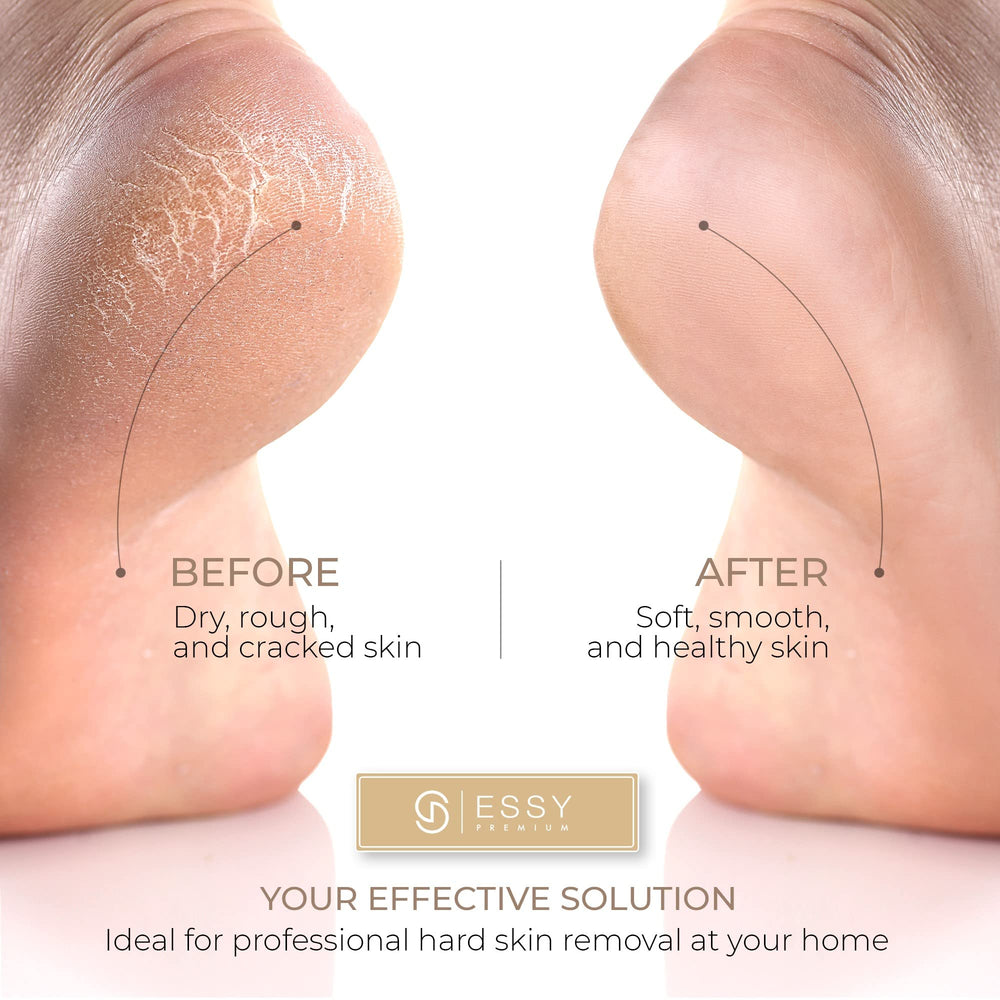 Essy in hand showing compact shape for easy at-home use