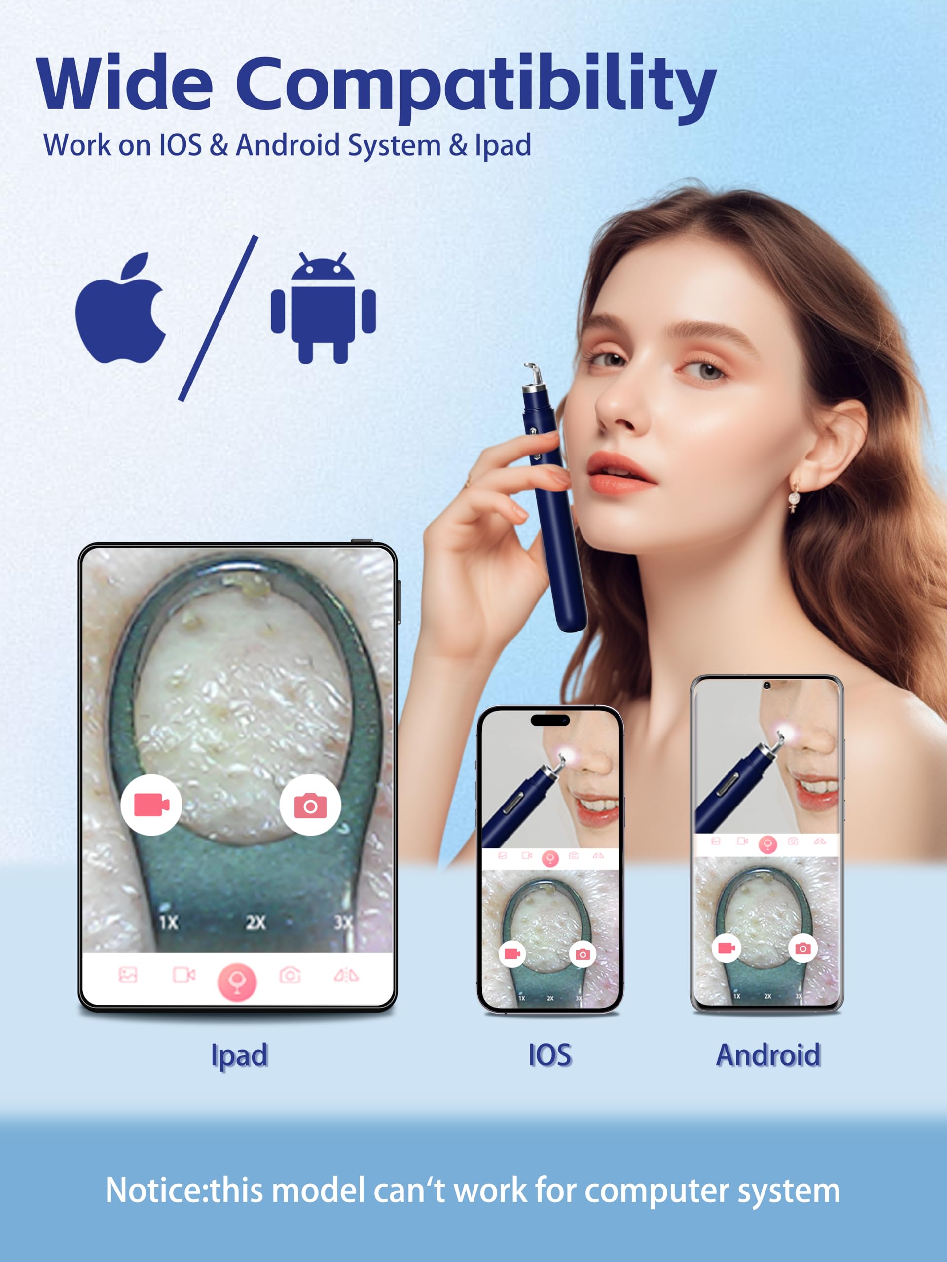 EURART smartphone displaying UDU app live stream for guided extraction and better results
