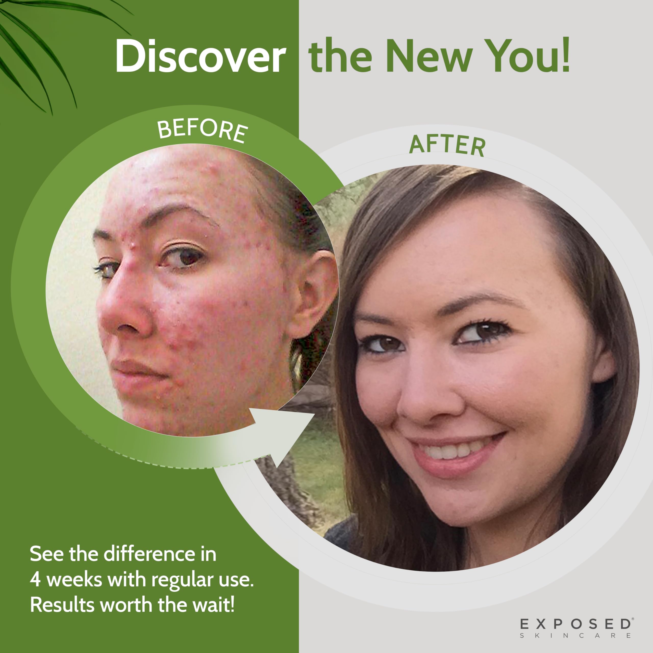 Exposed Skin Care sage extract ingredient shot showing soothing benefit