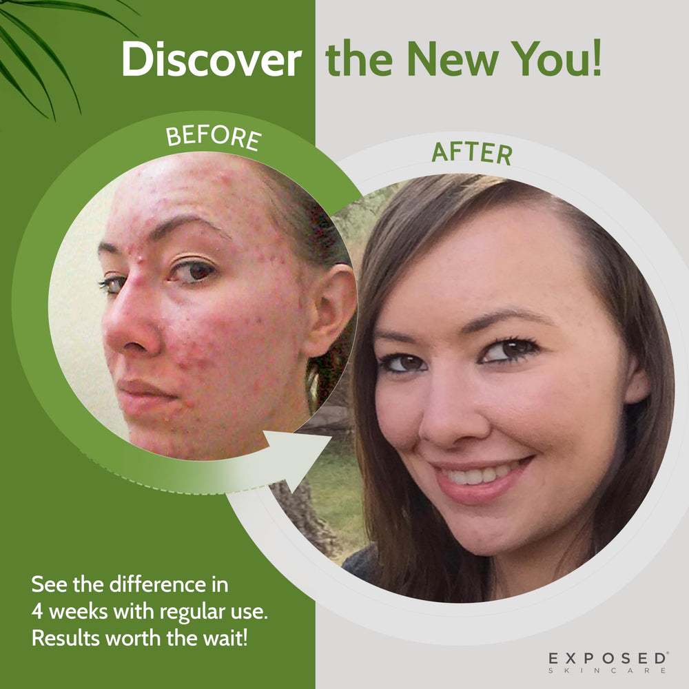 Exposed Skin Care sage extract ingredient shot showing soothing benefit