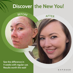 Exposed Skin Care sage extract ingredient shot showing soothing benefit