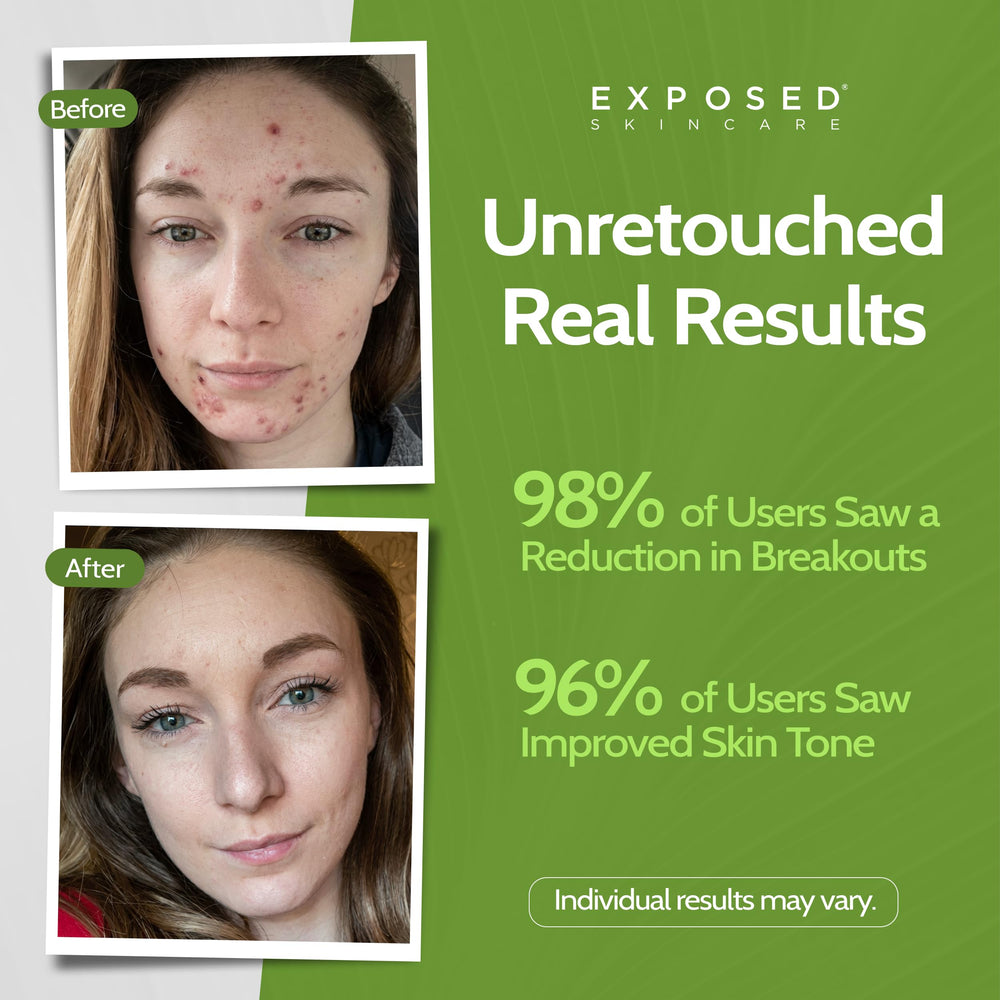 Exposed Skin Care cleanser foam texture showing gentle lather benefit