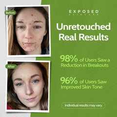 Exposed Skin Care cleanser foam texture showing gentle lather benefit