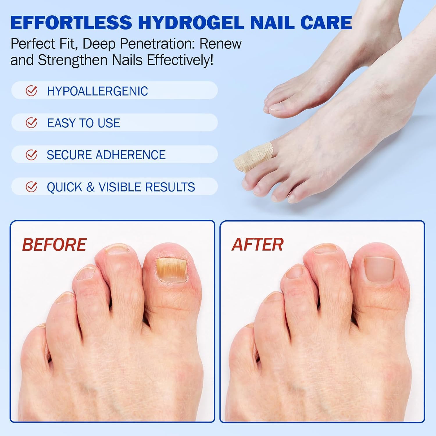 FANSHI patch on toenail overnight for discreet protection