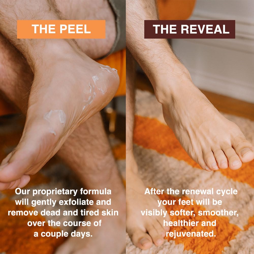 FEETS booties applied on feet demonstrating easy use