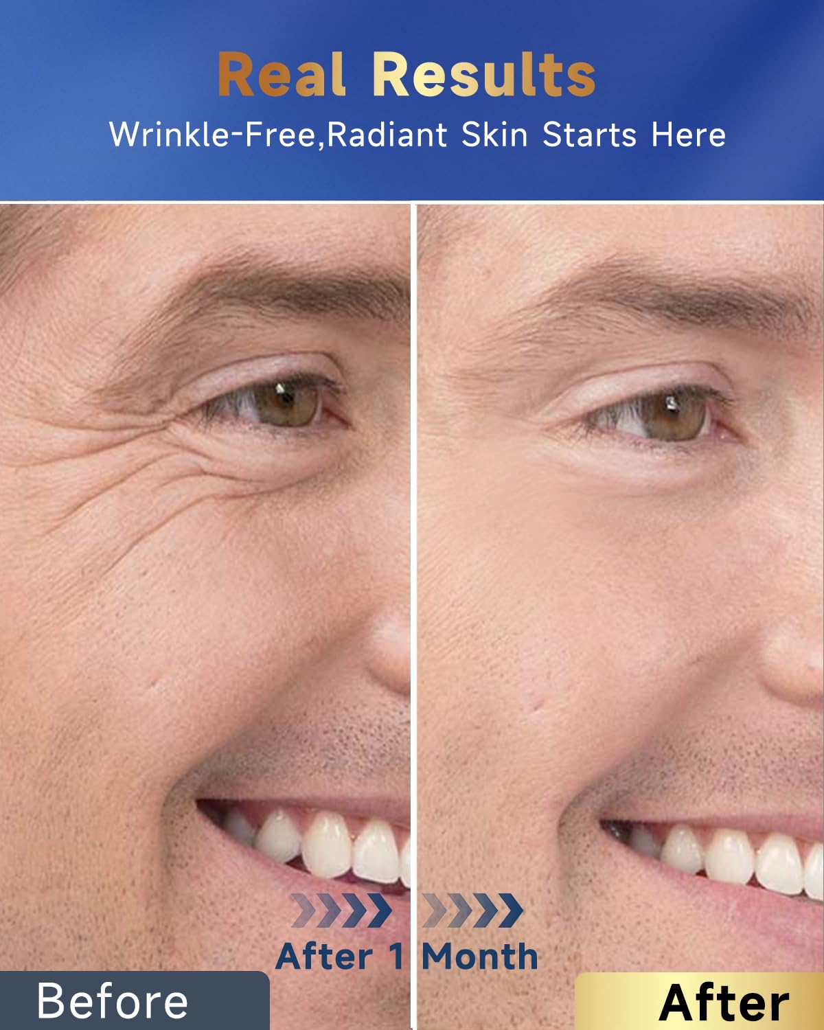 Felicemy applied after shaving to soothe skin and reduce redness visibly