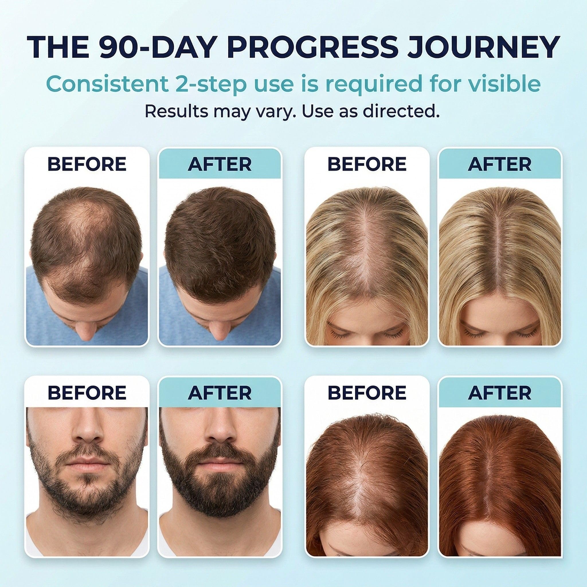 Fiimiu applied to scalp demonstrating targeted delivery and easy application