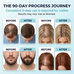 Fiimiu applied to scalp demonstrating targeted delivery and easy application