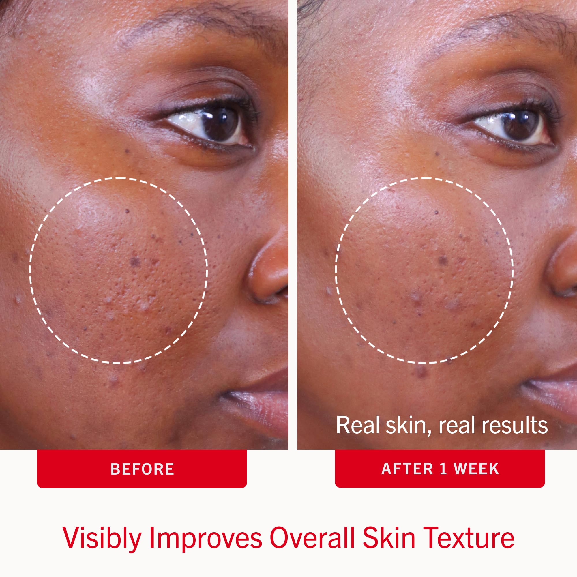 Close-up pad texture showing smooth, saturated pad for even treatment