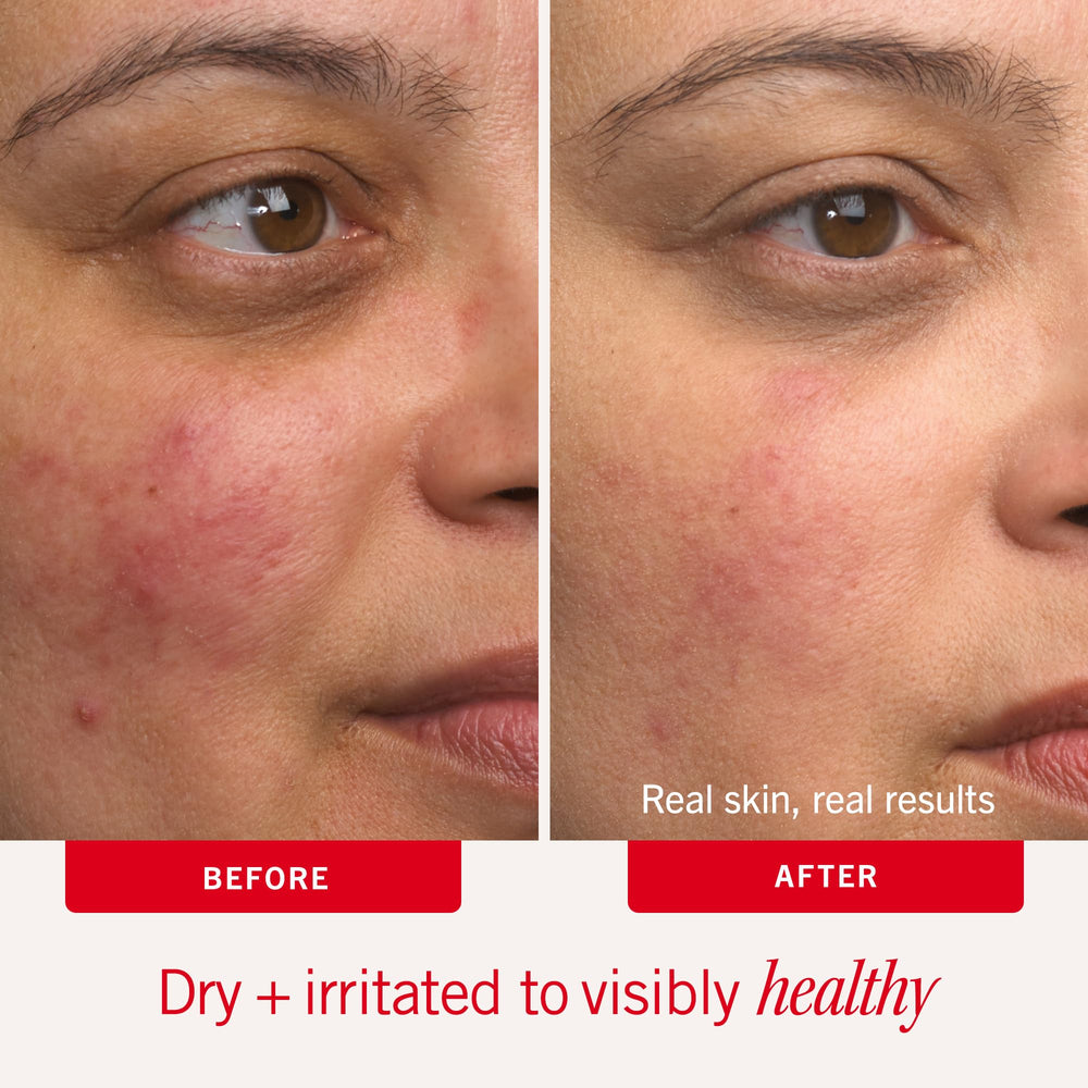 First Aid Beauty ingredient label close-up highlighting colloidal oatmeal