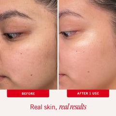 First Aid Beauty pre-soaked pad revealing lightweight exfoliating serum