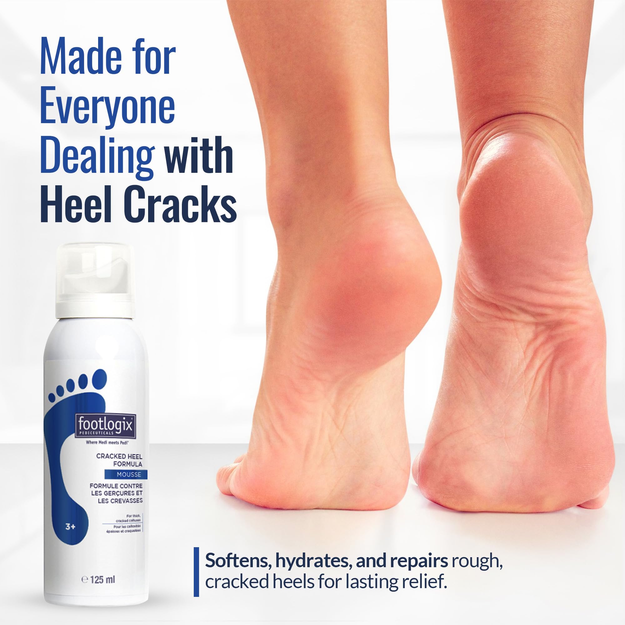 FOOTLOGIX product next to hand for scale conveying compact 4.23 oz size