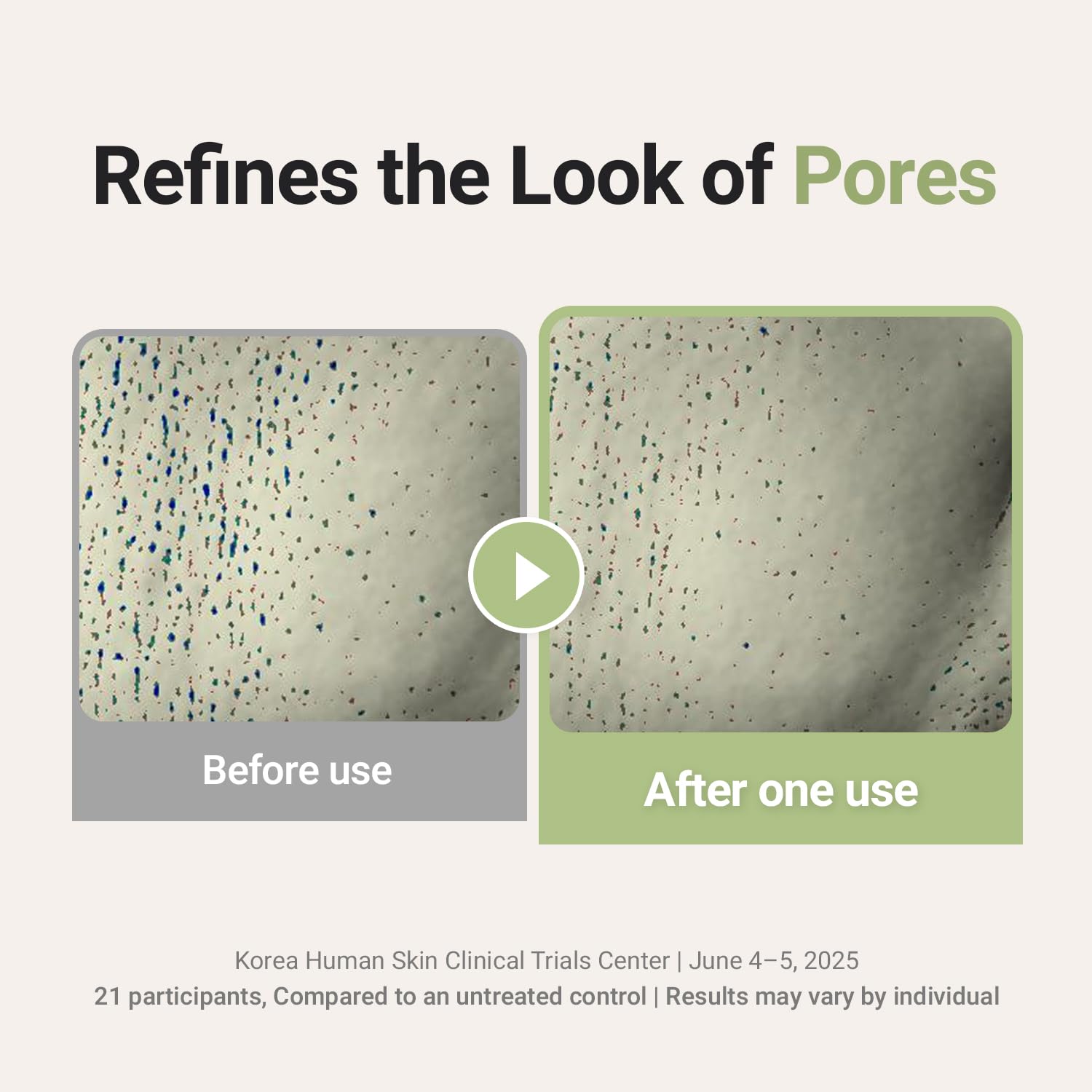 FORETDERM foam in hand demonstrating soft, buildable lather