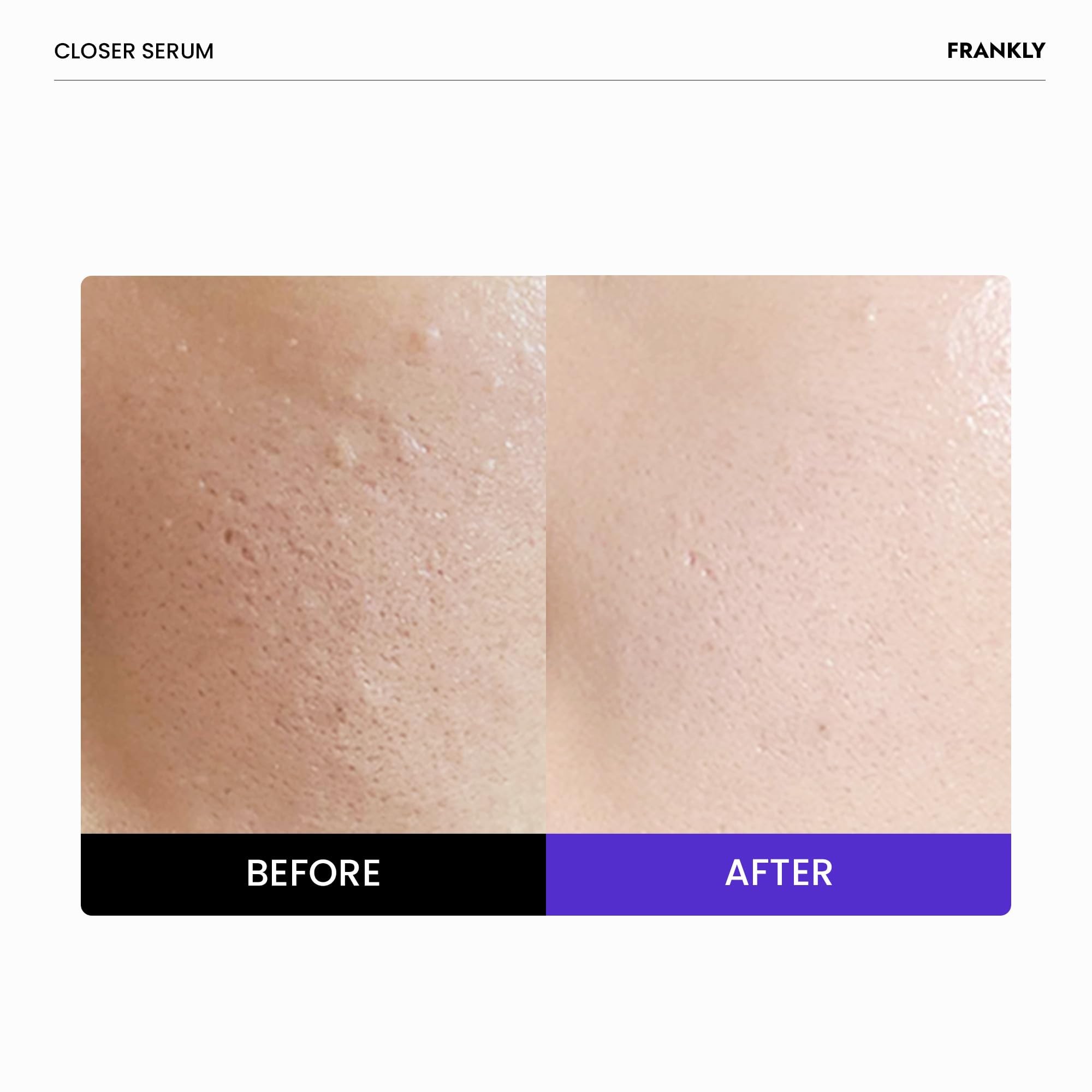 FRANKLY close-up of serum drop showing lightweight texture and quick absorption