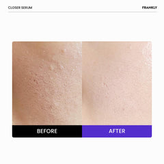 FRANKLY close-up of serum drop showing lightweight texture and quick absorption